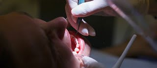 bleeding gums