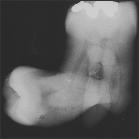 Anomalies of Tooth Structure (ce651) - Introduction