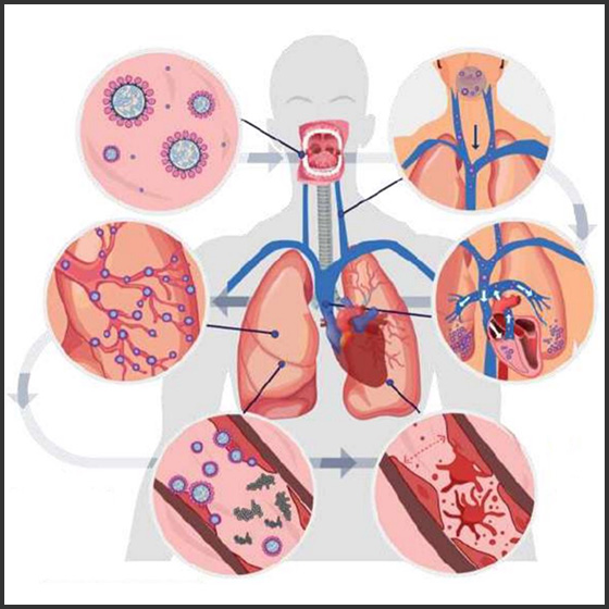 Introduction - What You Need to Know About the Coronavirus (COVID-19) Pandemic (ce652)